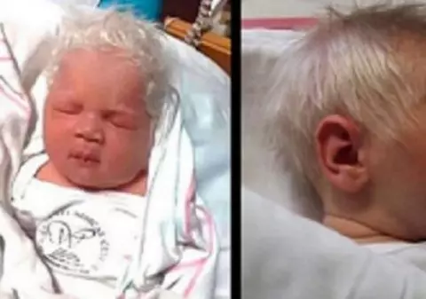 Povestea lui Bence este unică în lume. Nu suferă de albinism