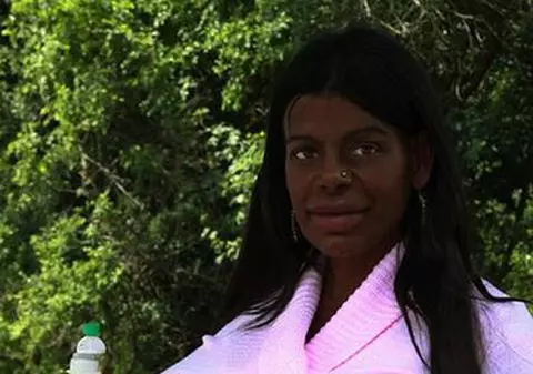 Și-a dorit întotdeauna ca pielea ei sa fie neagra asa ca a stat săptămâni întregi în solar și și-a injectat melanina pana a ajuns sa arate asa!