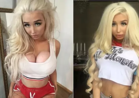 O tânără de 21 de ani vrea să devină o păpușă Barbie. Era să moară după ce și-a pus sâni de mărimea pepenilor, dar nu renunță la visul ei. Uite cum arată | FOTO