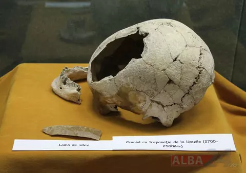 Operație pe creier în Munții Apuseni, în urmă cu 4.500 de ani. Cum interveneau medicii în Epoca Bronzului