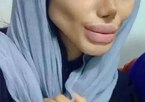 O tânără și-a făcut peste 50 de operații estetice pentru a semăna cu Angelina Jolie | FOTO