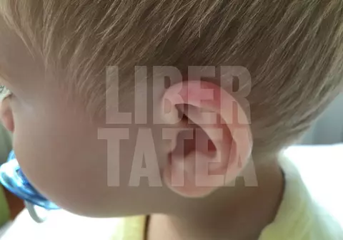 Ancheta în cazul copilului mușcat la grădinița privată din Arad a fost preluată de procurori. Acuzația este de neglijență în serviciu