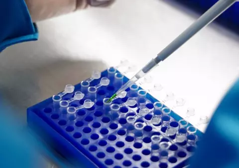 A fost descoperit un compus care blochează răspândirea cancerului pancreatic