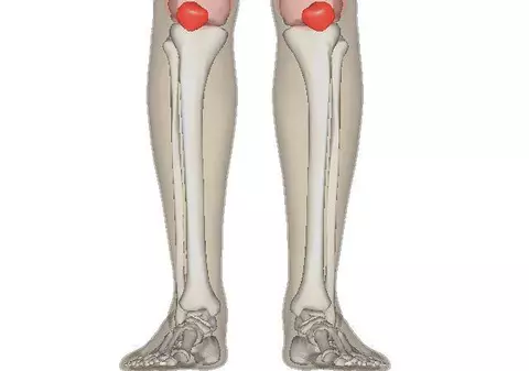 Medicii sunt uimiți. Acest tratament natural combate durerile articulare și previne osteoporoza