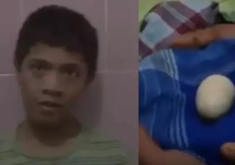 VIDEO | Cazul adolescentului care face ouă, precum găina. Medicii sunt șocați