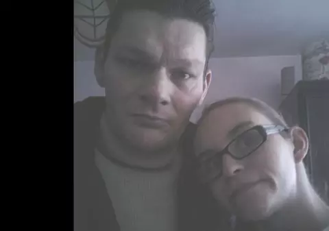 Și-au abuzat bebelușul de o luna atât de tare, încât a fost necesar să i se amputeze picioarele