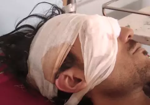 VIDEO | Un tată i-a scos ochii fiului său cu o lingură după ce tânărul a vrut să decidă cu cine se căsătorește
