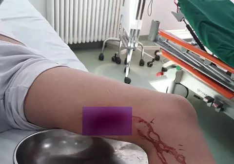 Un copil s-a rănit la un loc de joacă dezafectat, dintr-un parc din Buzău. Tatăl băiatului cere socoteală Primăriei/ FOTO