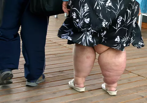 OMS avertizează că până în 2045 un sfert din populația globului va fi obeză
