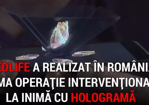 Pacienții scapă de frica operației prin terapia intervențională la inimă cu hologramă
