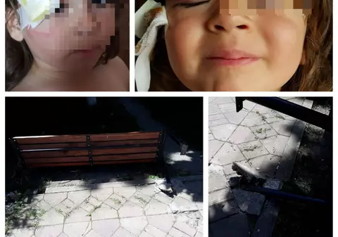 Un copil a fost rănit într-un parc din Murfatlar. Băiețelul de trei ani a fost strivit de o bancă