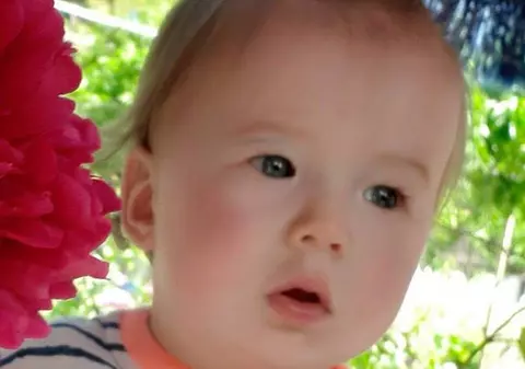 Micuțul Valentin are nevoie de ajutorul nostru pentru a duce o viață normală. Băiețelul s-a născut cu o malformație a vălului palatin și riscă să se sufoce în somn