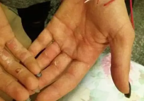 Așa arată palmele canotorilor medaliați cu aur la Europene. ”Să punem punct văicărelilor”