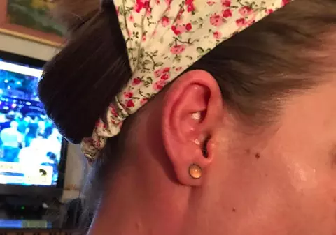 Jurnalista Nora Dincă este grav afectată de expunerea la gazele toxice. Cum arăta după protest