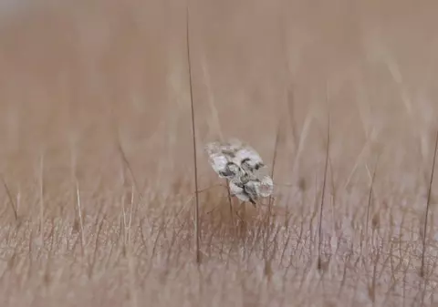 Dosar "Tigrul de platan". "Insecta şi-a dezvoltat abilitatea de a suge sânge uman", dezvăluie medicii din Franţa