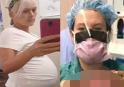 O femeie care părea gravidă a ajuns de urgență la spital. Medicii au rămas uimiți de ce au descoperit