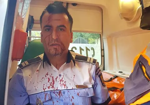 UPDATE. Polițist din Craiova, bătut cu telefonul mobil de un șofer pe care a încercat să-l rețină. Imagini șocante cu omul legii după agresiune