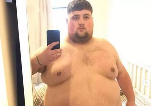 FOTO/ Cum arată bărbatul care a reușit să slăbească peste 100 de kilograme. Acum are o altă problemă