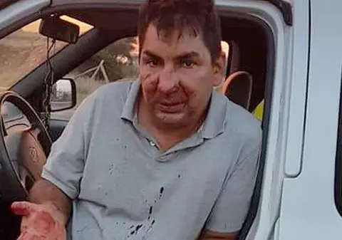 Un gest de bun simț l-a costat enorm! Român bătut de 7 indivizi în Italia, doar pentru că le-a cerut să nu arunce gunoaie în parc