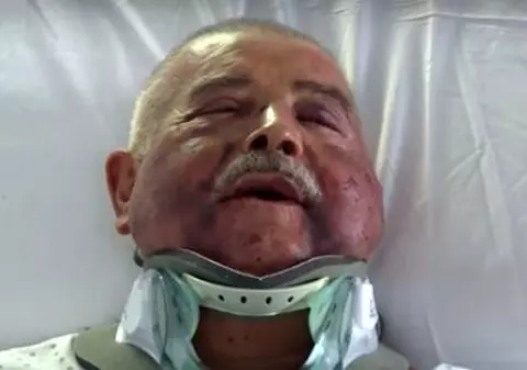 O nouă mărturie a medicului italian torturat de o bandă de români: "Tot ce vreau este să uit"