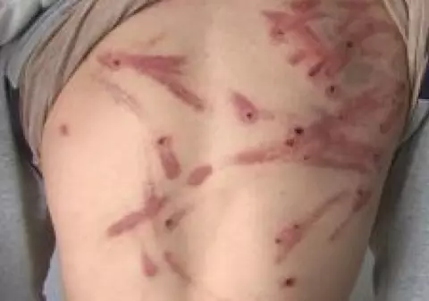 Un tată și-a snopit copiii în bătaie cu o sârmă: "Perdelele erau pline de sânge!"