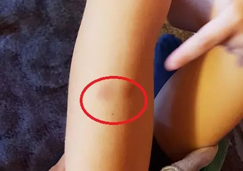 Un băiețel din Lugoj ar fi fost înțepat în spate, mușcat și lovit de colegi