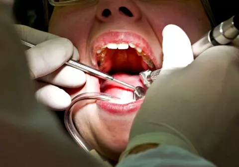 O româncă e supranumită dentistul „măcelar” în Franța. A fost condamnată după ce a mutilat zeci de pacienți