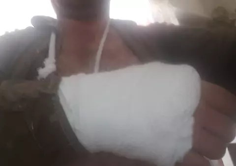 Poliția Locală Ploiești: Bărbatul care a acuzat ”mascații” că i-au rupt mâna și-a provocat singur rănile