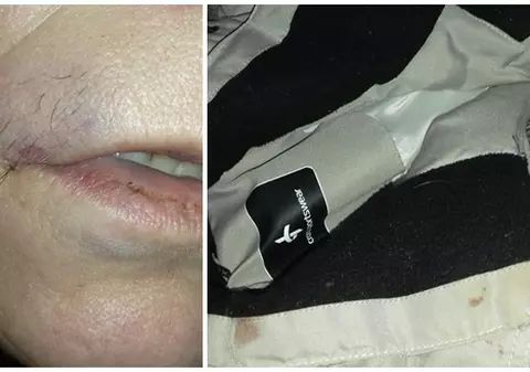 Una din femeile bătute de individul băut la Timișoara și-a povestit calvarul: ”M-a lovit cu pumnii în cap, dădea ca animalul”