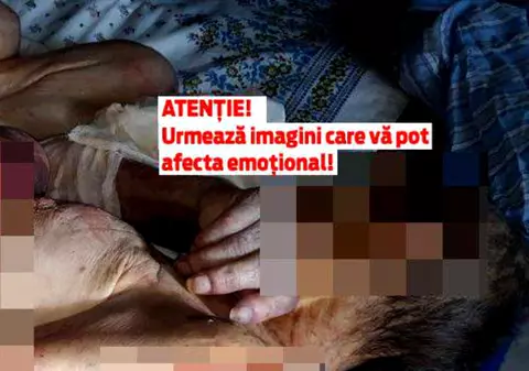 Rana din inima noastră. Bătrâna de 79 de ani pasată între familie și spital arată gradul de cinism la care au ajuns atât oamenii, cât și instituțiile