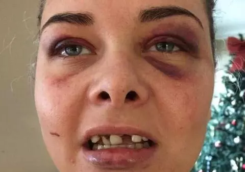 Un bărbat și-a bătut iubita și i-a spart trei dinți din cauză că a schimbat poza de pe Facebook și el nu mai apărea în ea