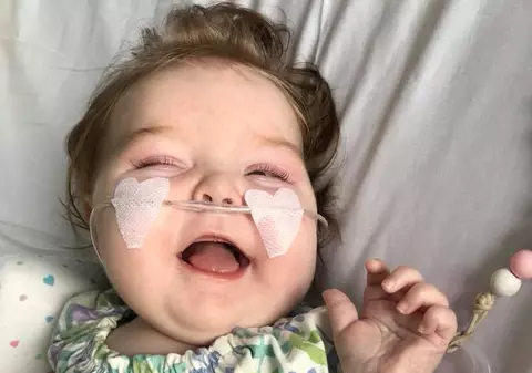 Un bebeluș din Marea Britanie are convulsii din cauza ciocănitului la ușă. Boala nedepistată care o face pe fetiță să-și țină respirația de 15 ori pe zi