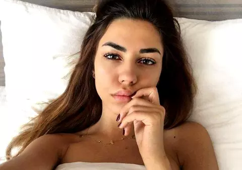 Mira a descoperit că are 5 cioburi în faţă, la mai bine de un an de la accident. Imaginea a devenit publică