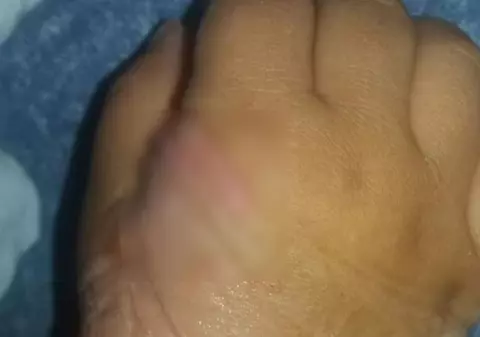 Asistente de la Spitalul din Videle, acuzate că au rănit grav un băiețel de nici doi ani. „Mi-au nenorocit copilul că nu au ele chef”