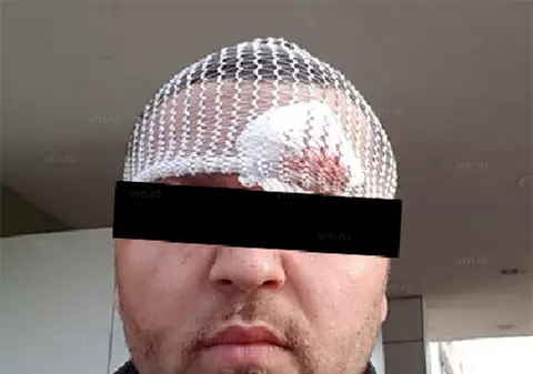 Bodyguarzii dintr-un club din Vaslui, acuzați că ar fi bătut cu sălbăticie doi tineri. Oamenii de ordine ar fi încercat să le recruteze partenerele pentru videochat