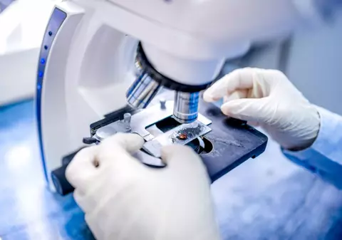 Studiul care le dă speranțe bolnavilor de cancer: O terapie creşte cu 50% şansele de supravieţuire pe termen lung pentru pacienţii cu melanom