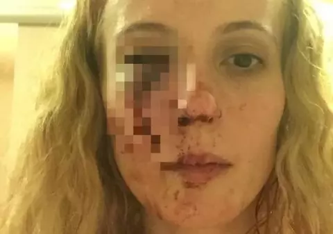 Româncă bătută de mai mulți tineri în Anglia. "Le-am spus să vorbească mai încet că dorm copiii"