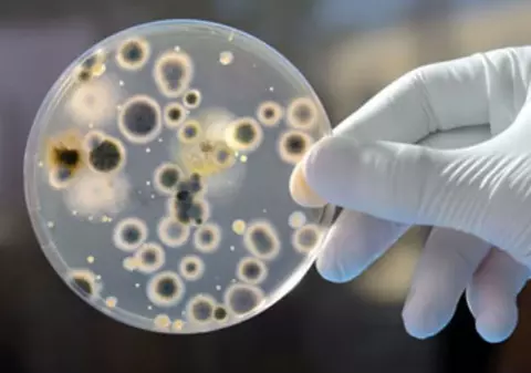 O infecție misterioasă se răspândește în tăcere pe tot globul