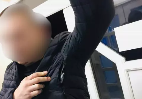 Un bărbat acuză un polițist de agresiune: "M-a lovit și m-a mușcat de mână!"