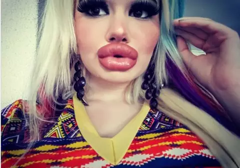 O bulgăroaică s-a operat de 15 ori în ultimul an ca să arate ca păpușa Barbie