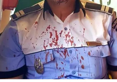 Un polițist vasluian a ajuns la spital după ce s-a dus să pună în aplicare un ordin de protecție!