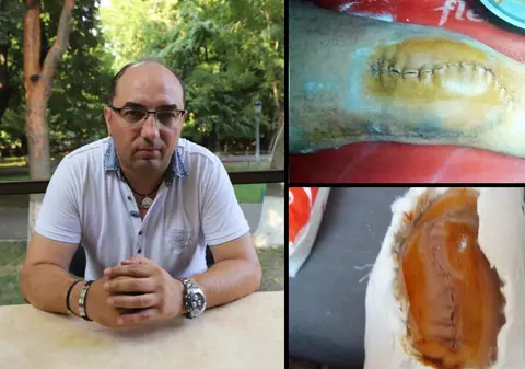 Unui avocat i-a fost rupt piciorul demonstrativ în centrul Craiovei, după ce s-a implicat într-un dosar de trafic de persoane și proxenetism a doi frați, unul fost polițist! Replica fetei