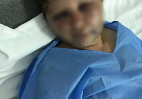 Un polițist din Olt e acuzat că a desfigurat în bătaie o femeie: „Mi-a dat cu pumnii și cu picioarele”