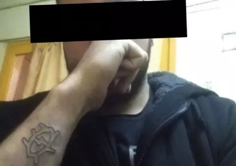 Un tânăr din Argentina și-a șters tatuajul de pe mână cu o răzătoare