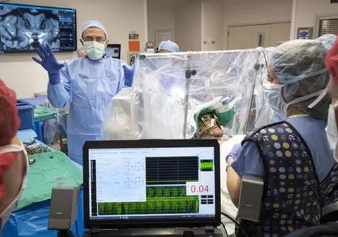 Experiment în premieră, în Statele Unite. Un implant în creier e folosit pentru a combate dependența de droguri