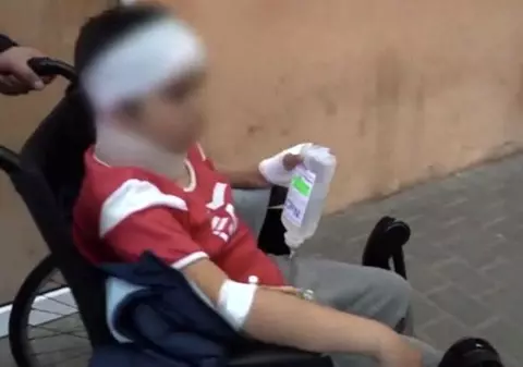 Băiat de 11 ani din Pașcani, bătut zdravăn de tatăl unei colege. A fost internat la neurochirurgie