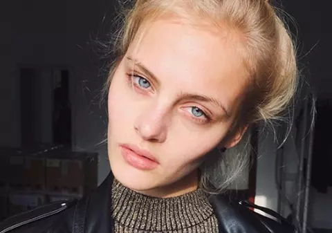 Un model rus se zbate între viață și moarte după ce a căzut de la etajul trei