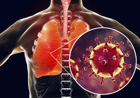 Cum prevenim răspândirea coronavirus (COVID-19) si cum ne protejăm. Recomandările MAI