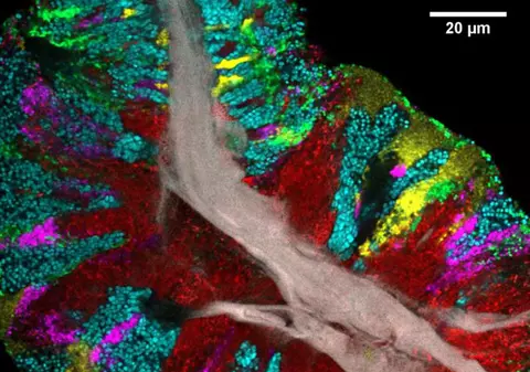 Cercetătorii au evidențiat coloniile de microbi de pe limba umană cu ajutorul culorilor