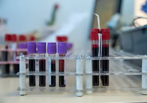 „Nu ne-am mai confruntat niciodată cu așa ceva”. Ce se întâmplă la Centrul de Transfuzii Sanguine din București în criza provocată de coronavirus